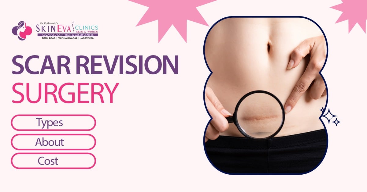Scarrection Scar Correction Surgery Cost in Jaipur, Scar Revision Surgery Jaipur